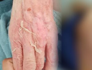Huzurevindeki Acı Mevt Sonrası 2 Görevliye Mahpus Cezası