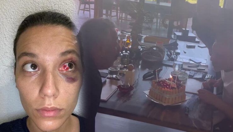 Bayana şiddetten yargılanan Ozan İtimat, Cem Yılmaz’la mum üfledi