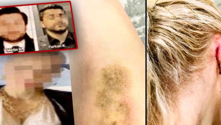 Ünlülerin avukatına taarruz: Kulağı yırtıldı saçlarından sürüklendi!