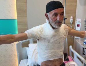Tamir etmek isterken hastanelik oldu: Bedeninde yanık oluştu