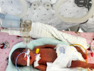 650 gram doğmuştu: Leyla bebek 4 aylık hayat savaşını kazandı