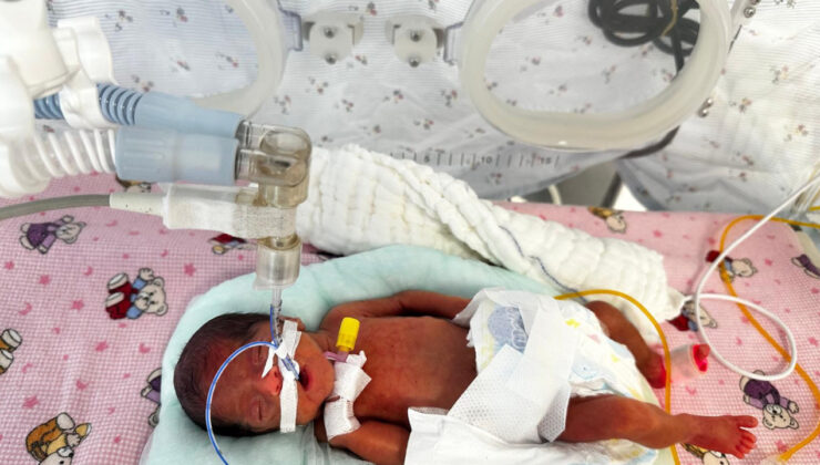 650 gram doğmuştu: Leyla bebek 4 aylık hayat savaşını kazandı
